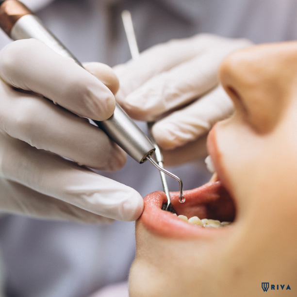 paura del dentista cosa fare | Riva Dental Clinic