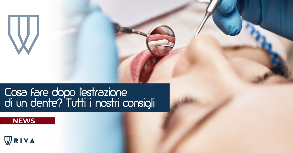 cosa fare dopo l'estrazione di un dente | Riva Dental Clinic | Dentista a Milano