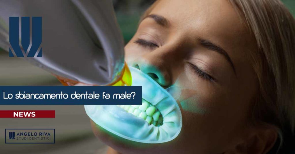 sbiancamento-dentale-fa-male