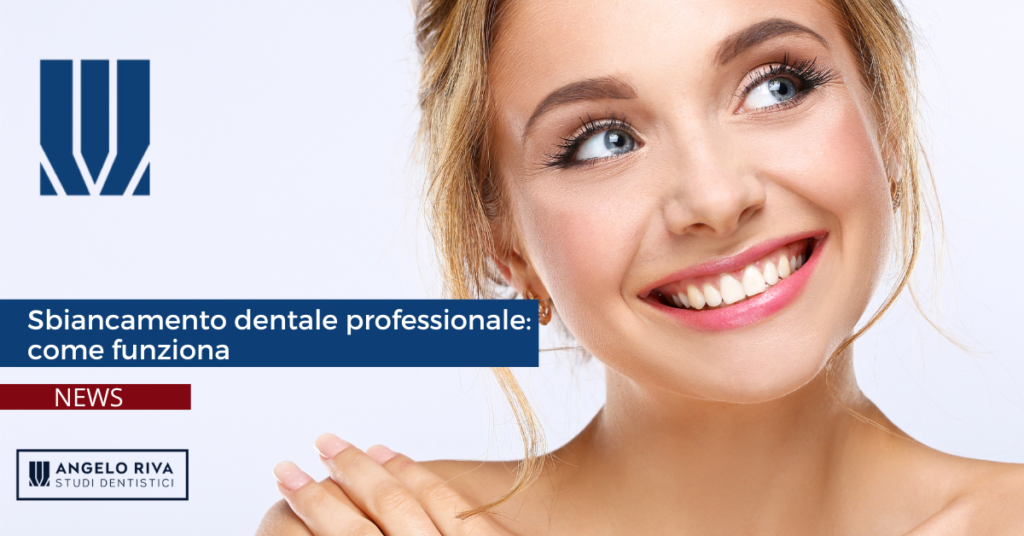 Sbiancamento dentale