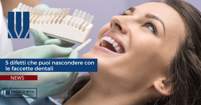 faccette dentali faccette dentali